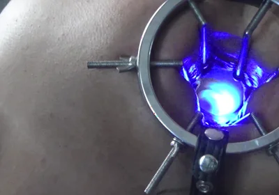 Backdoor Lightshow