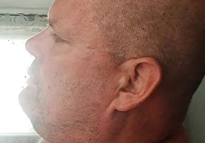 Renewed Destruction of the Bitch