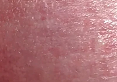 Sperm Close-up Front