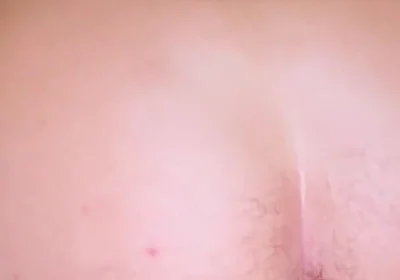 Losing My Anal Virginity