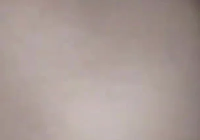 Destroying the Asshole on the Dick