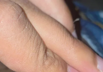 Closeup
