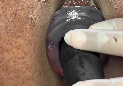 Ass Gape