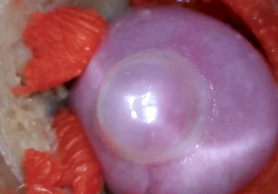 The Camera Inside the Deep Pussy Records a Huge Ejaculation with a Stuck Condom 4K