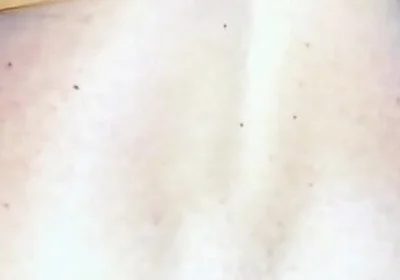 Extreme Anus Gape