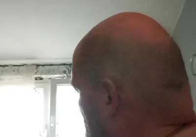 After Days Without Stretching, Freshly Stretched the's Ass Again