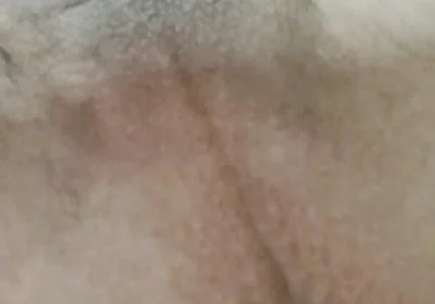 Nl Slut