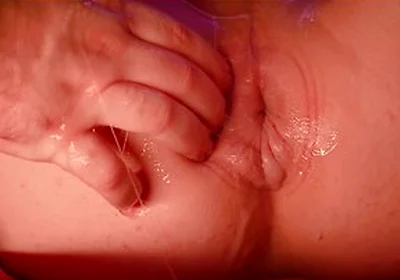 Rose Bud In Fisting A Pumped Donut