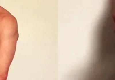 Masturbation