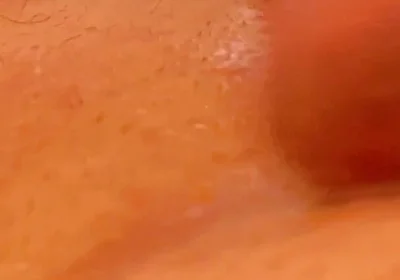 Just One Testicle for a Huge Load of Cum!