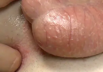 Stick Your Fingers in Casper's Butt