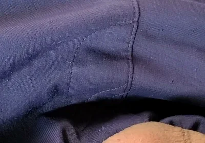Sucked by Mosquito