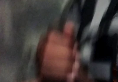 My Hand Exploded When Exposed to Masturbation