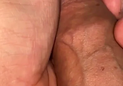 Sounding Extreme Sharp Probing in the Urethral Canal.