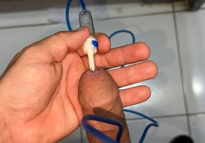 Sounding Extreme Sharp Probing in the Urethral Canal