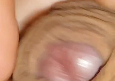 The World's Largest Foreskin Opening and Closing.