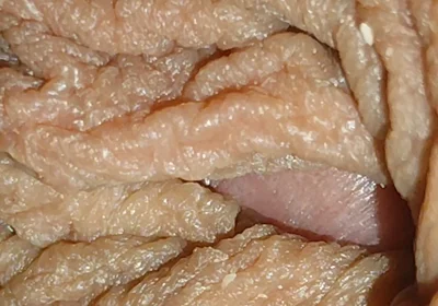 The World's Largest Foreskin Opening and Closing.