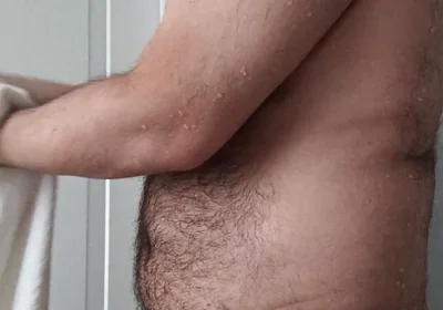 Drying off