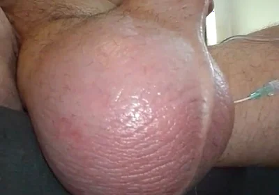 My Plump Juicy Watermelon Getting a Feeding