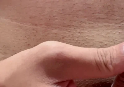 Papaya Seeds Inserted Into the Urethra