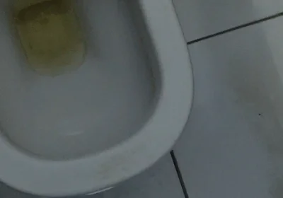 Homemade Method for Freezing the Penis