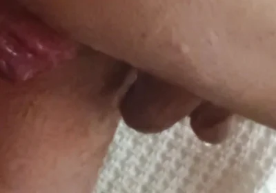 Prolapse and Urine