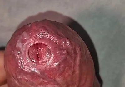Close up on Phimosis Large Cock, so Hot!