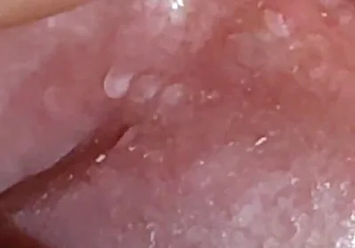 Super Daddy Enlarged Hole Pulsing with Horniness.