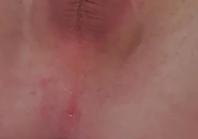 Playing with Butt Plug