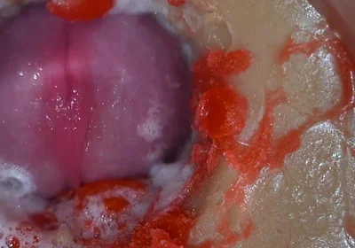 Insemination - Internal Camera Captures Deep Male Ejaculation