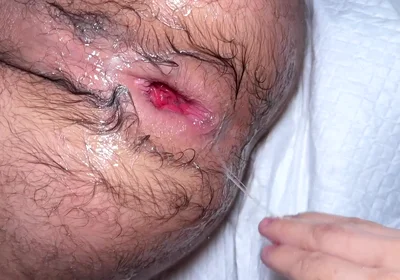 Masked Fister X Fisting Ffunantoni