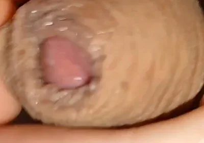 Cumshot of the Largest Phimosis Foreskin in the World.