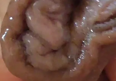 Large Foreskin and Balls in Striking Close-up.